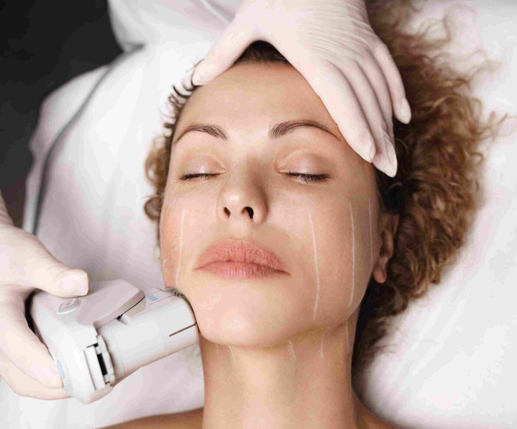 facelift-face-procedures-aesthetic-istanbul