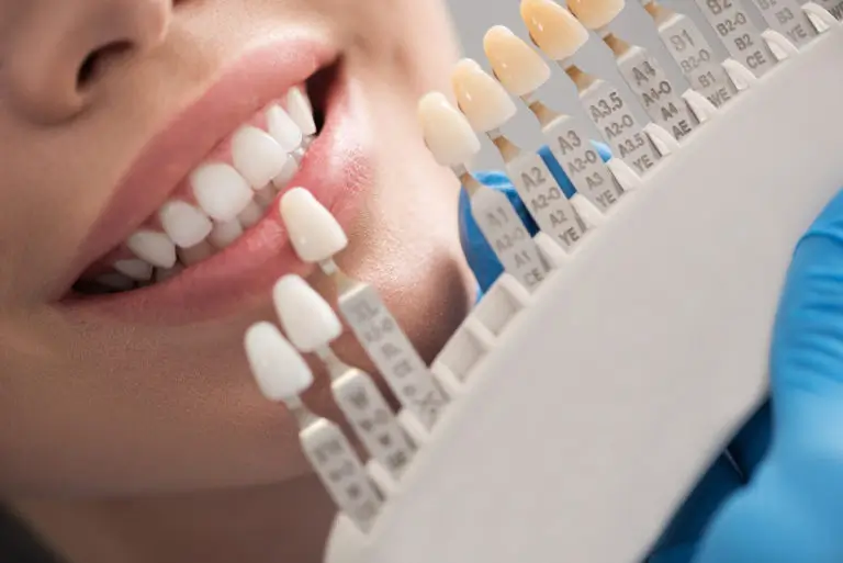 dental work cost in turkey